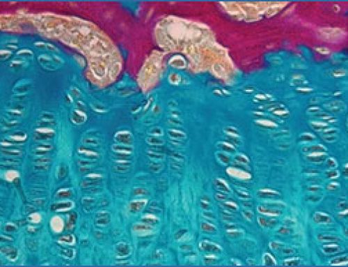 Genetic mapping identifies new hope for bone diseases